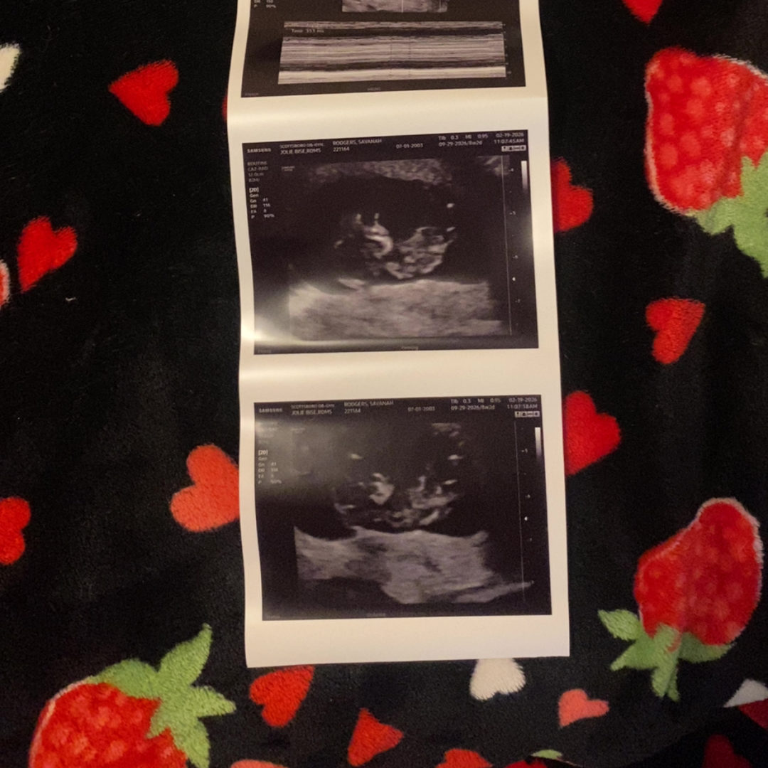 Photo shared by Savannah for their Babylist baby registry.