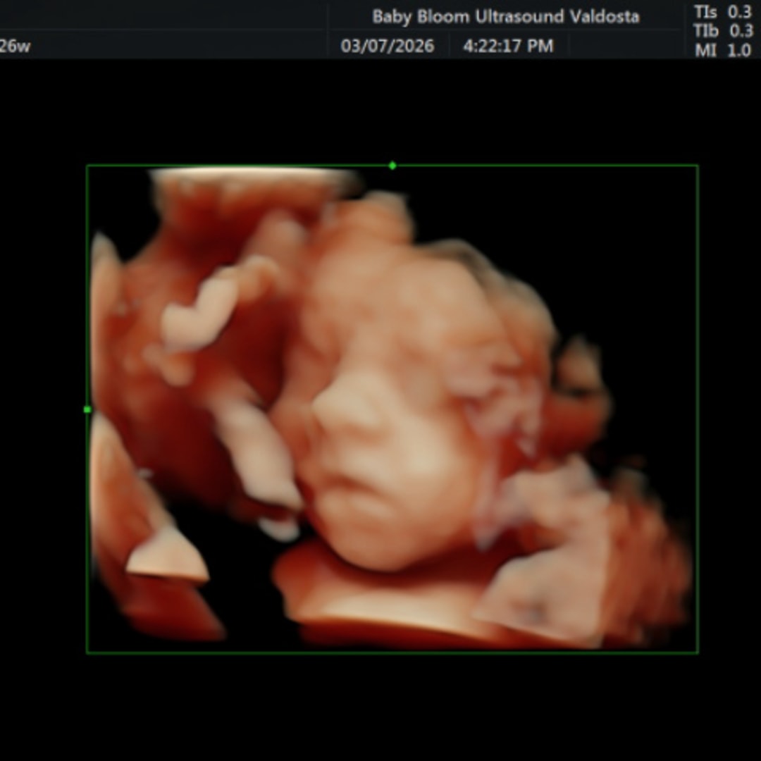 Photo shared by Jaime for their Babylist baby registry.