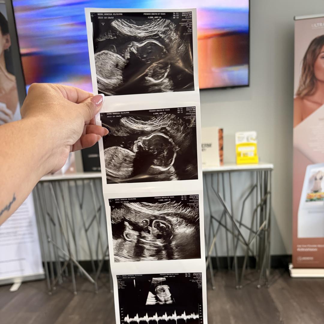 Photo shared by Vanessa for their Babylist baby registry.