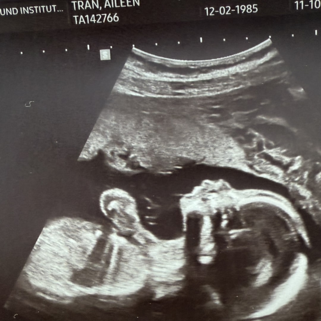 Photo shared by Aileen for their Babylist baby registry.