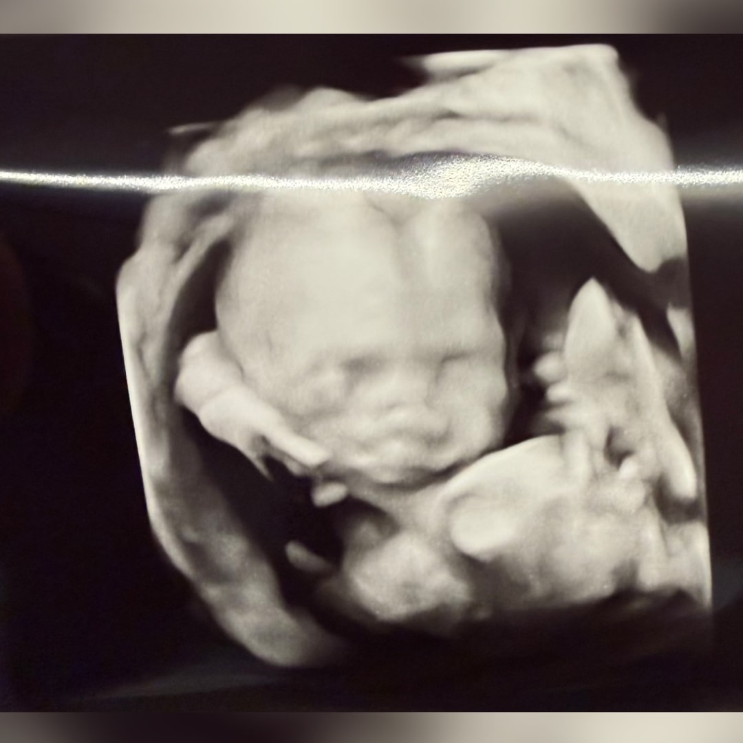 Photo shared by Aubrey for their Babylist baby registry.