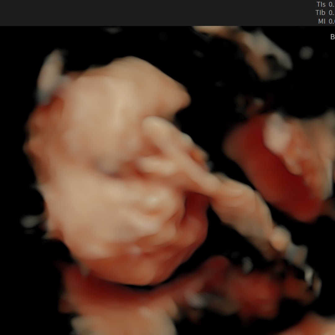 Photo shared by Sierra for their Babylist baby registry.