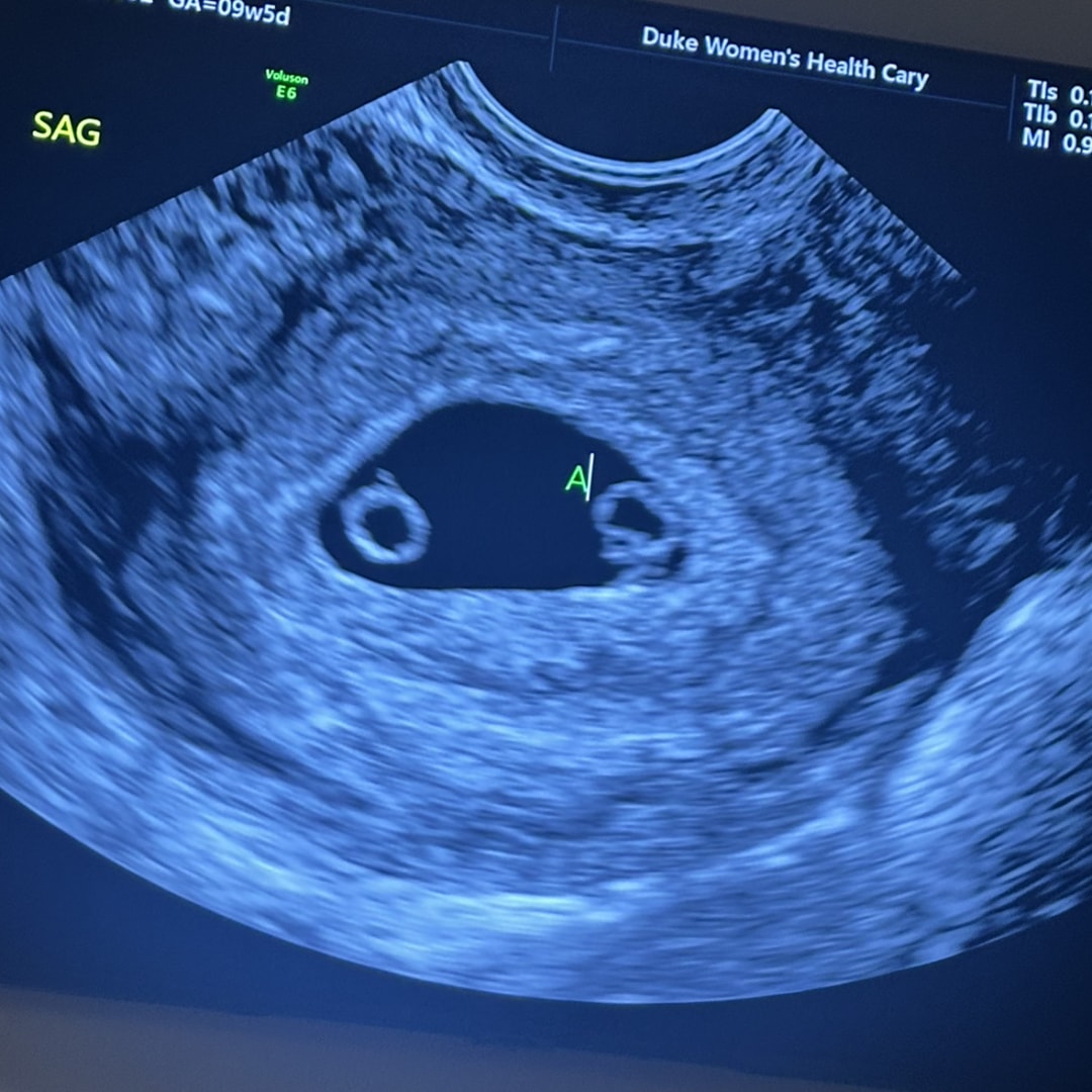 Photo shared by Kat for their Babylist baby registry.