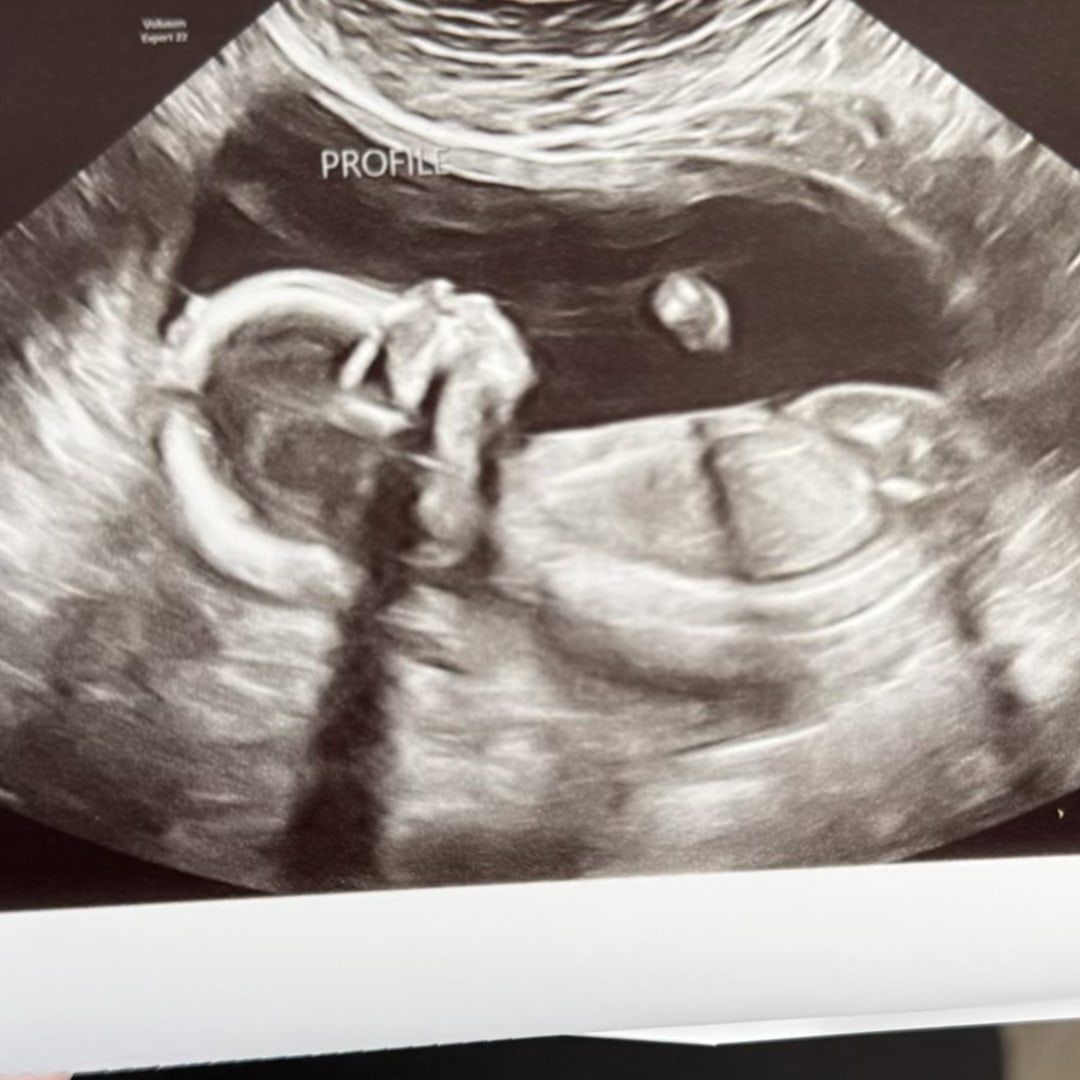 Photo shared by Nakia for their Babylist baby registry.