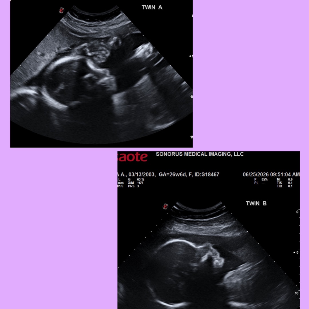 Photo shared by Aaliyah for their Babylist baby registry.