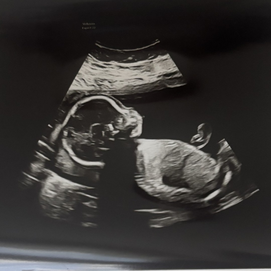 Photo shared by Areli for their Babylist baby registry.