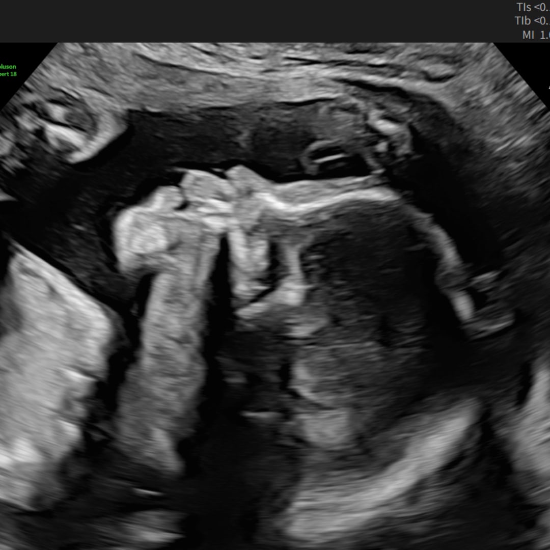 Photo shared by Bridget for their Babylist baby registry.