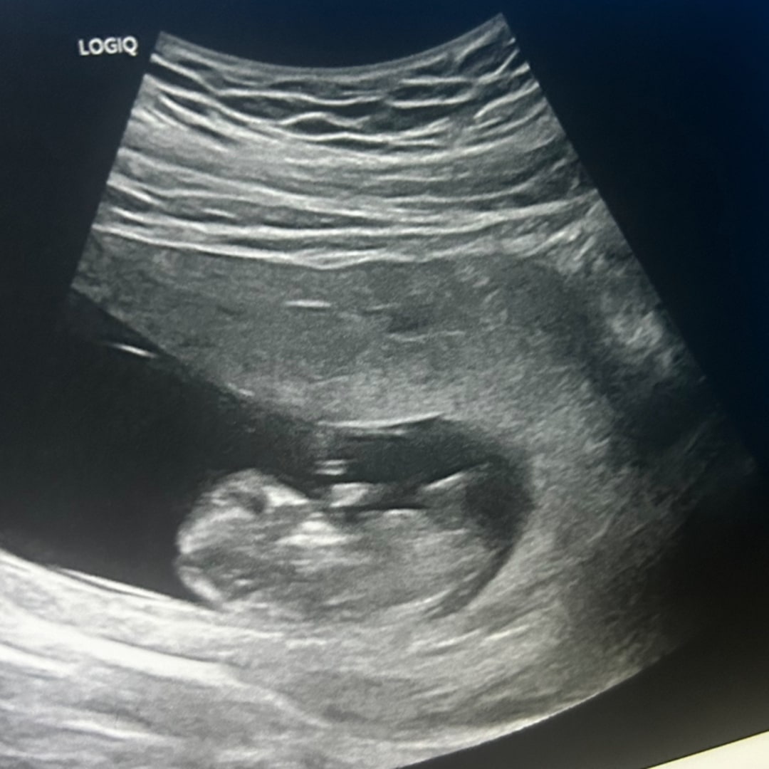Photo shared by Ashli for their Babylist baby registry.