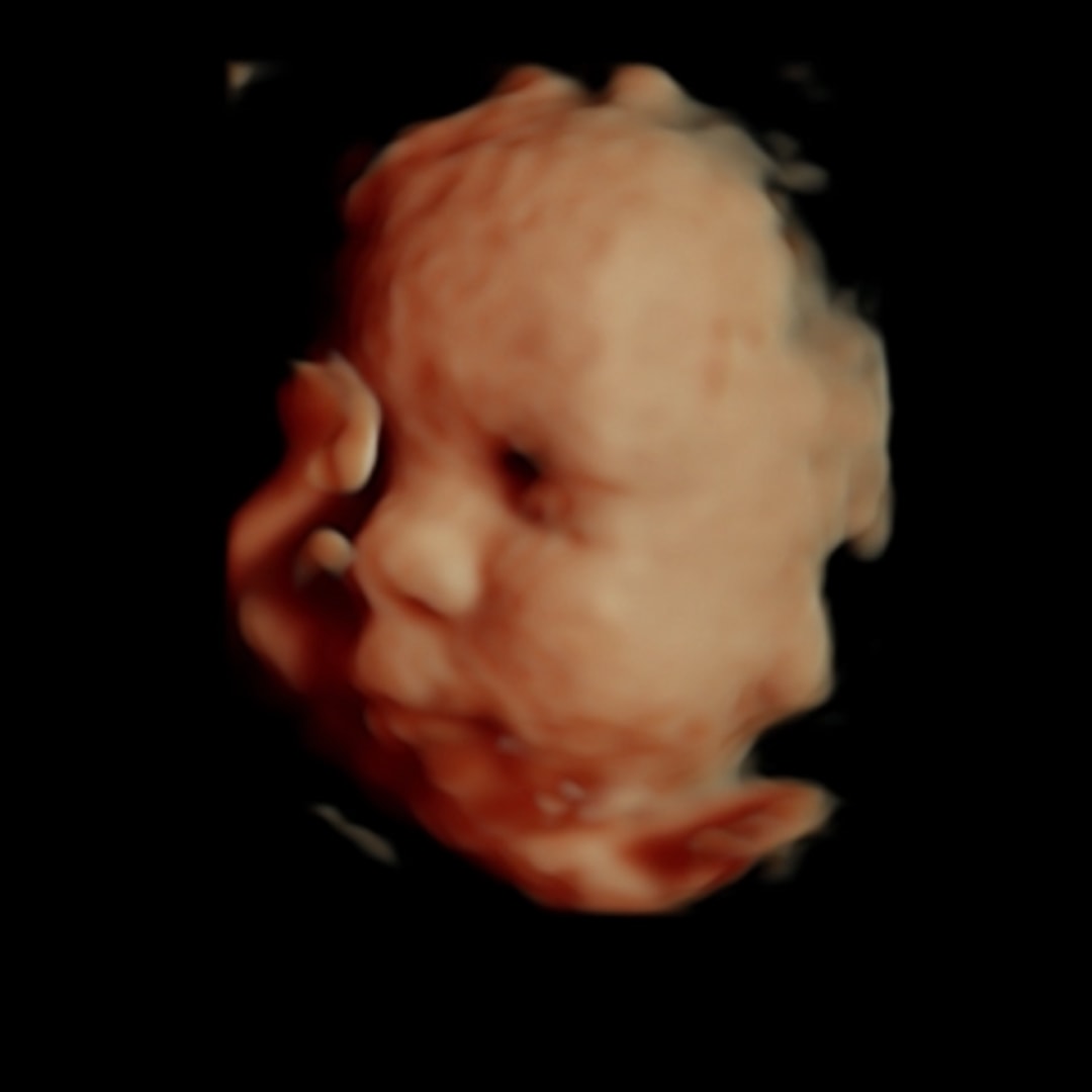Photo shared by Lindsay for their Babylist baby registry.