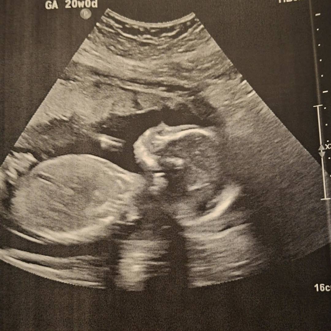 Photo shared by Danae for their Babylist baby registry.