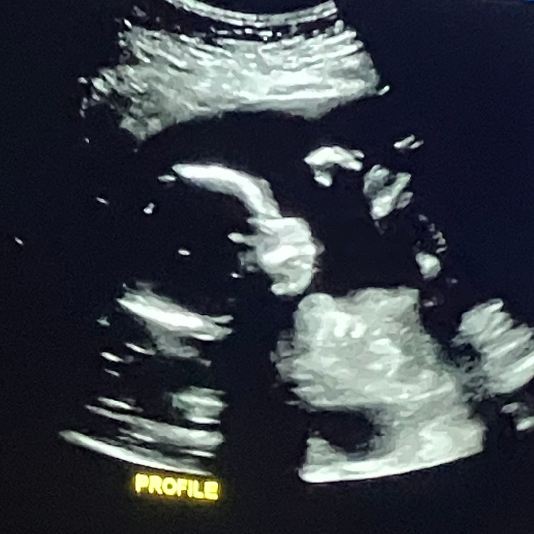 Photo shared by Haley for their Babylist baby registry.