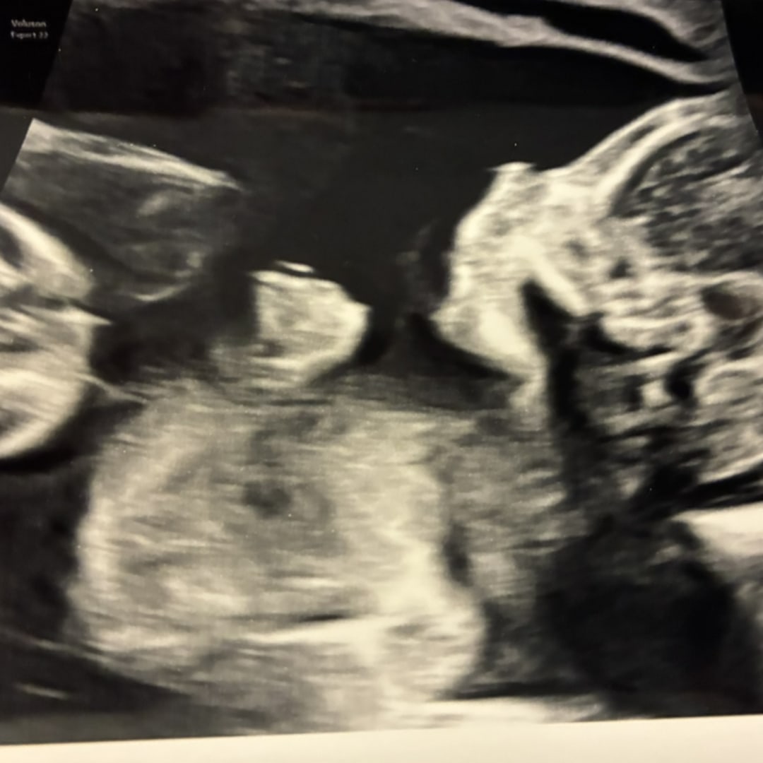 Photo shared by Aimee for their Babylist baby registry.