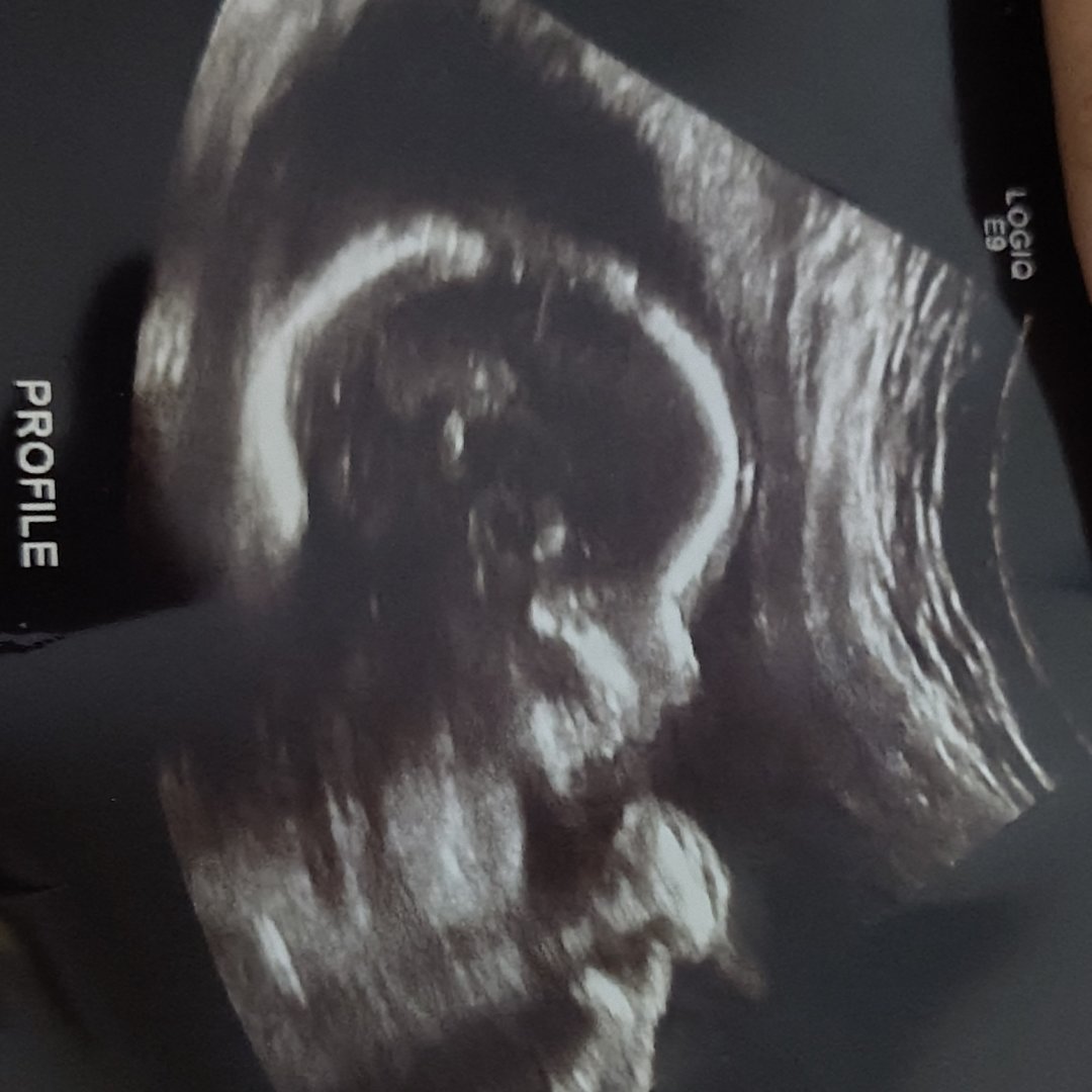 Photo shared by Brianna for their Babylist baby registry.