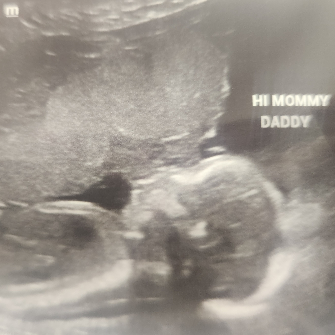 Photo shared by Natasha for their Babylist baby registry.