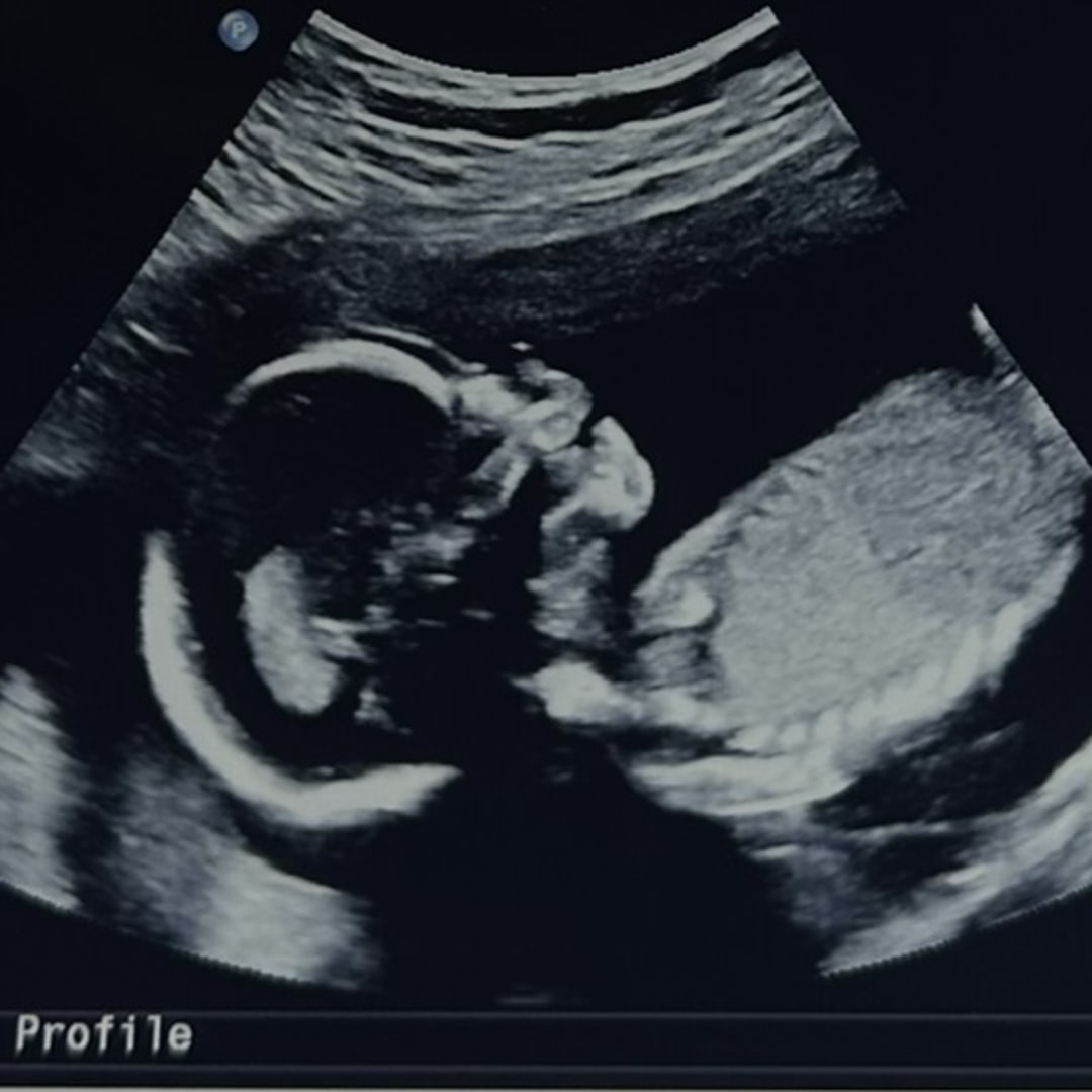 Photo shared by Sydnee for their Babylist baby registry.