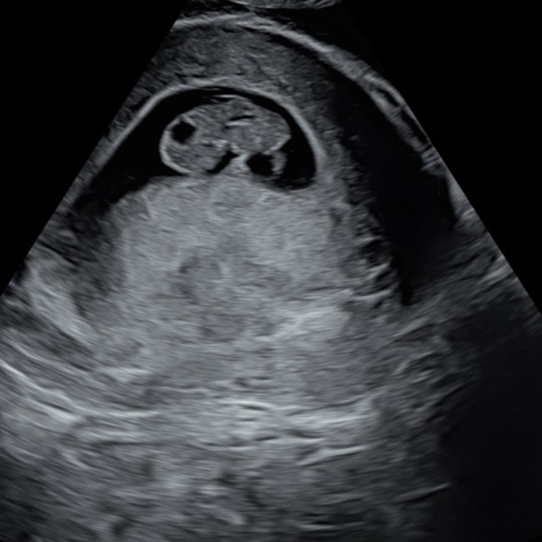 Photo shared by Elivia for their Babylist baby registry.