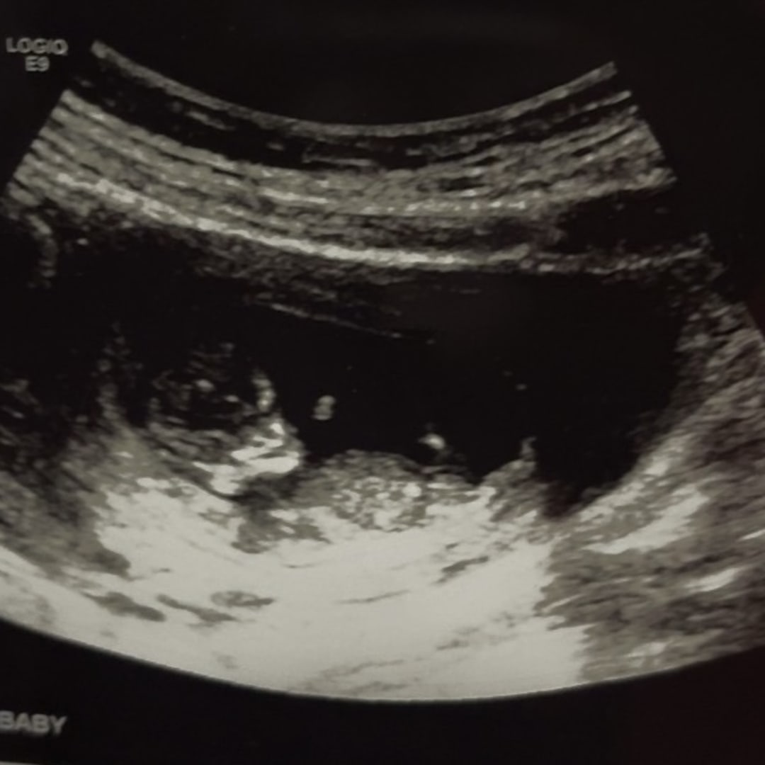 Photo shared by Alisa for their Babylist baby registry.