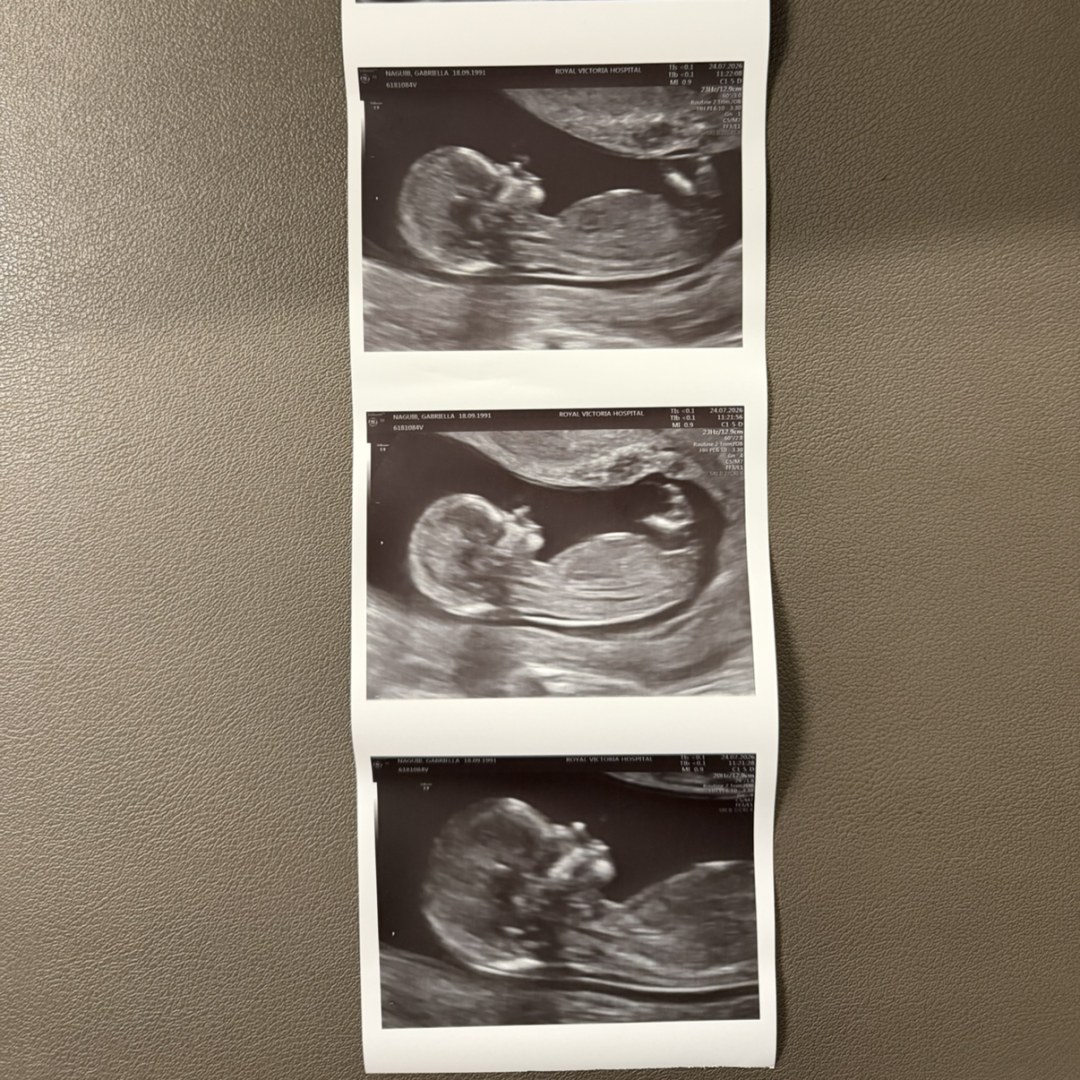 Photo shared by Gabriella for their Babylist baby registry.
