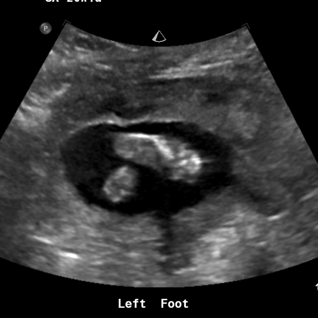 Photo shared by Kinley for their Babylist baby registry.