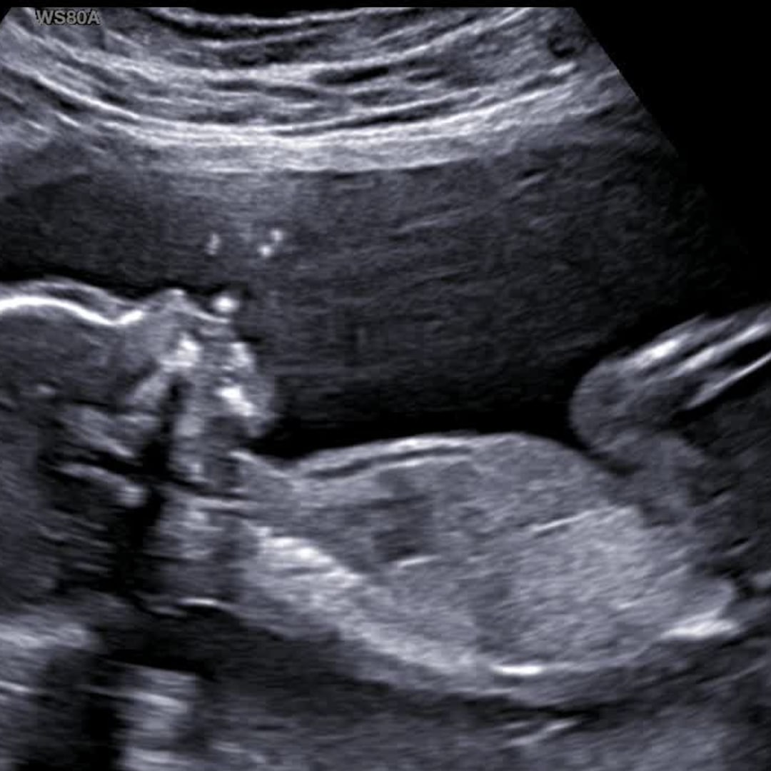 Photo shared by Toka for their Babylist baby registry.