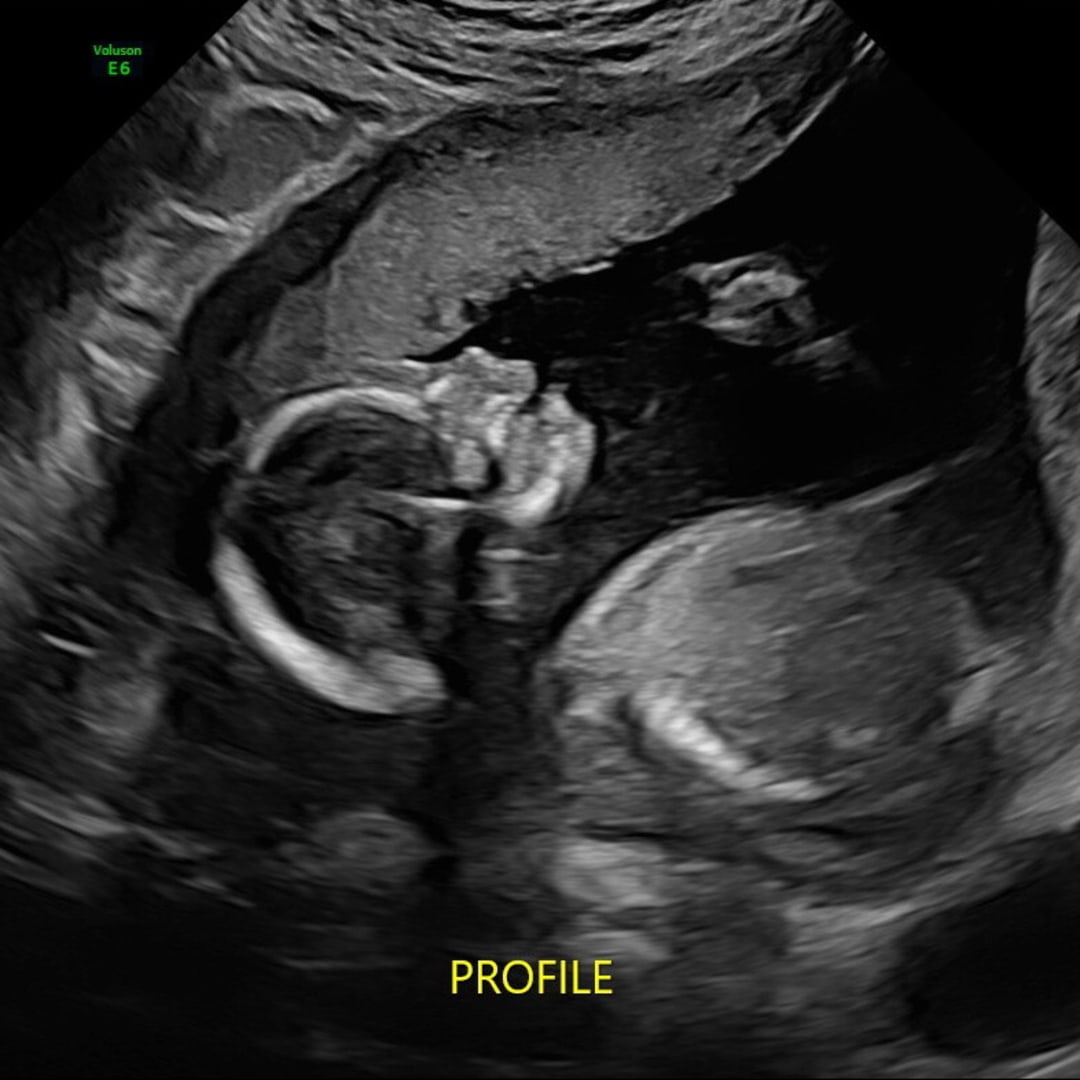 Photo shared by Madelyn for their Babylist baby registry.