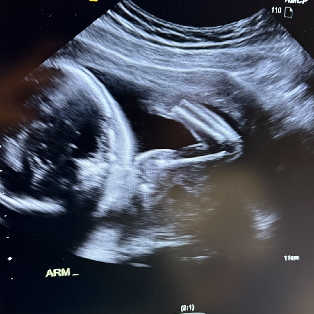 Photo shared by Jacey for their Babylist baby registry.