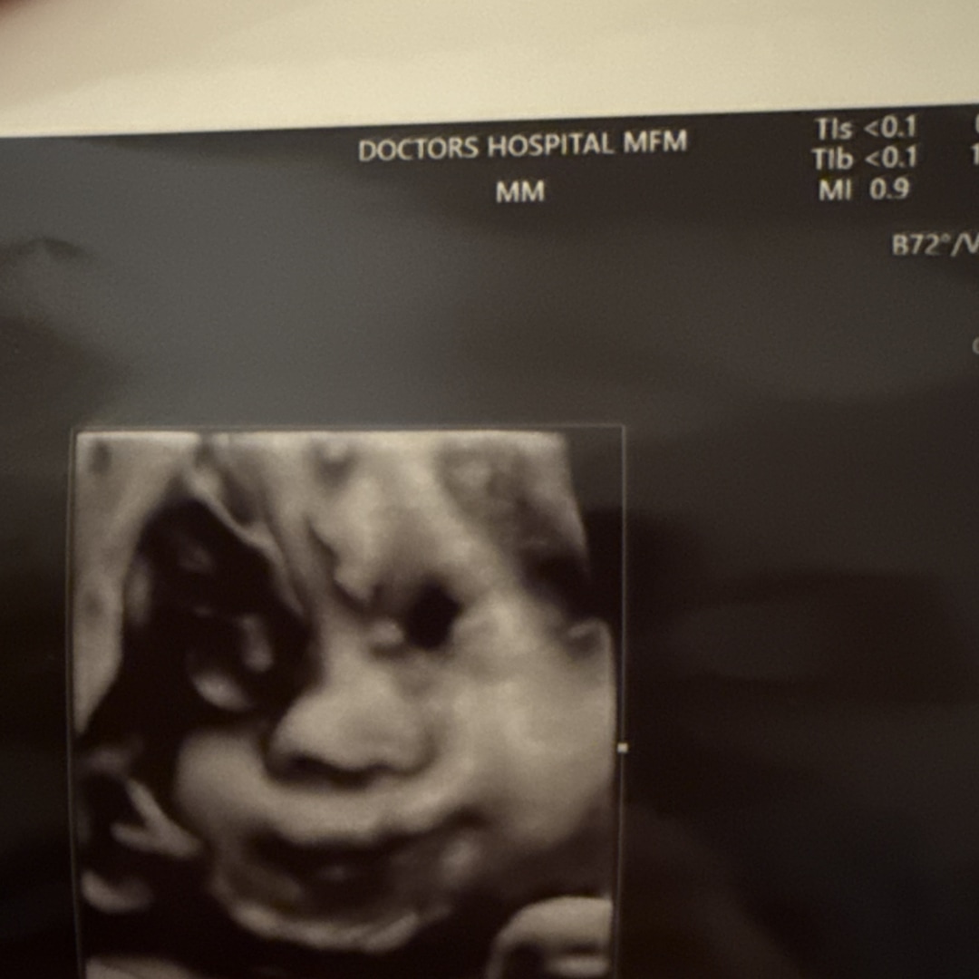 Photo shared by Emma for their Babylist baby registry.