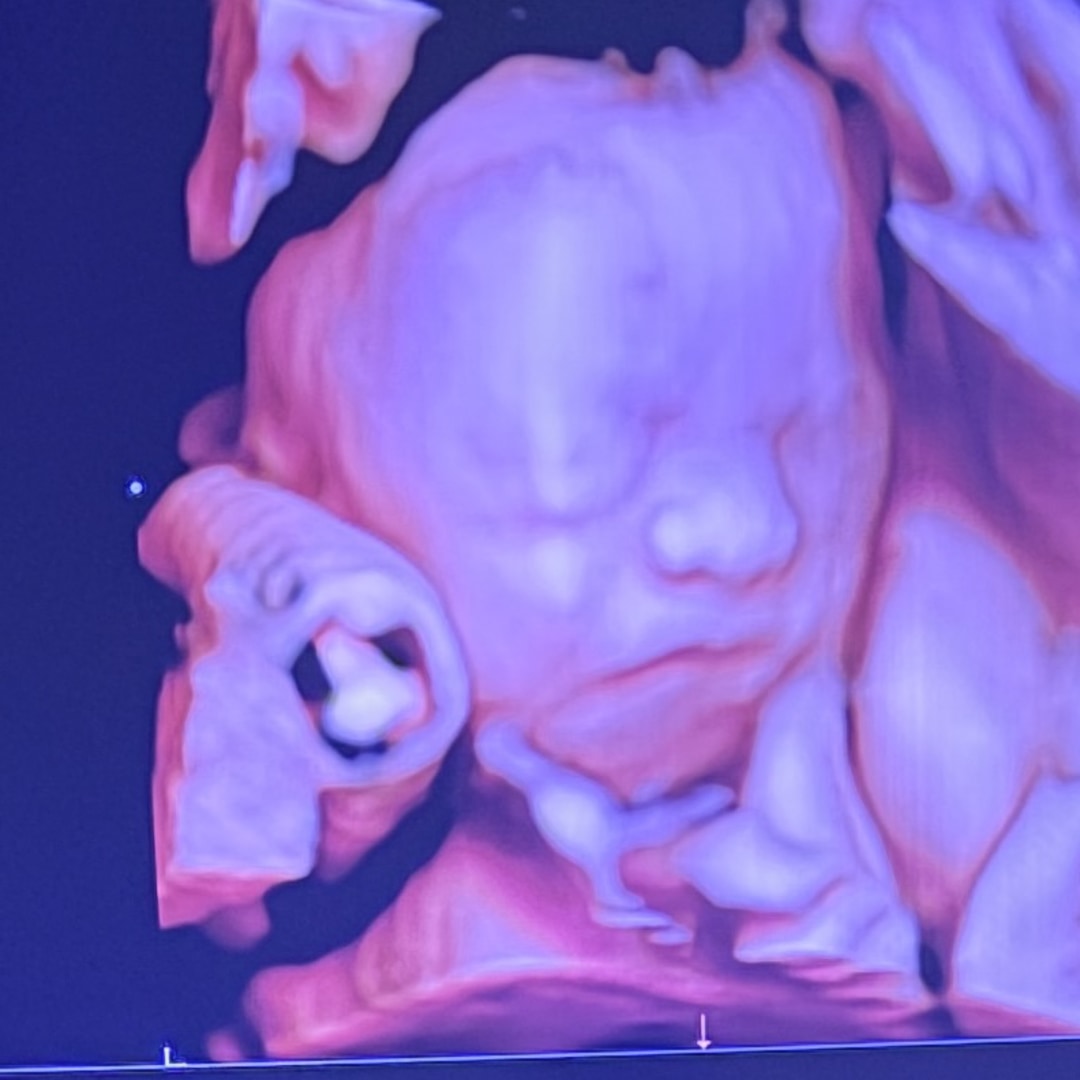 Photo shared by Daniel for their Babylist baby registry.