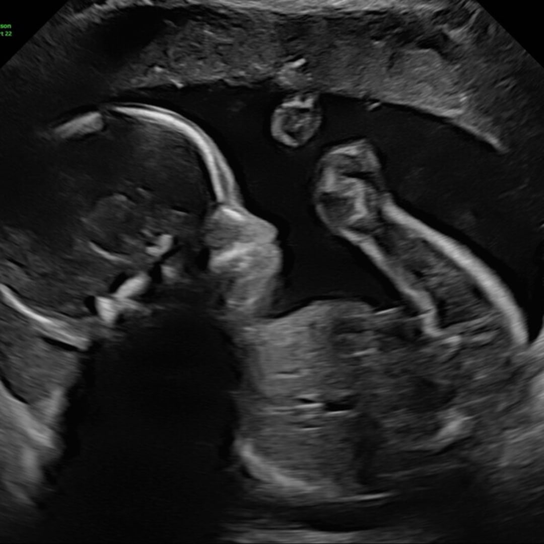 Photo shared by Alexis for their Babylist baby registry.