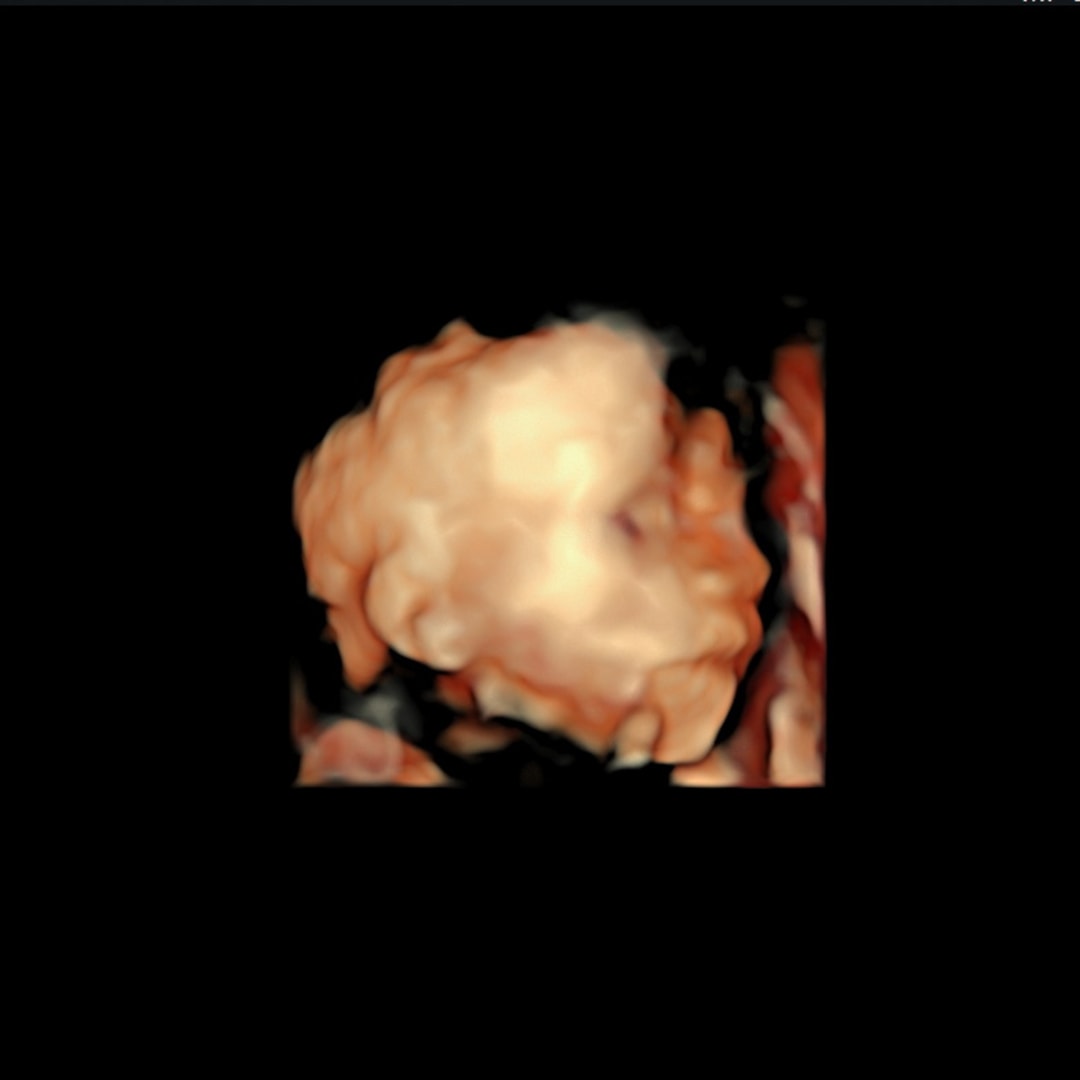Photo shared by Makenzie for their Babylist baby registry.