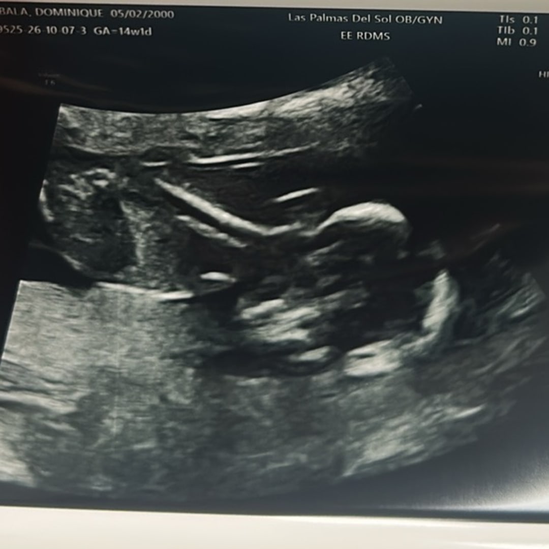 Photo shared by Dominique for their Babylist baby registry.