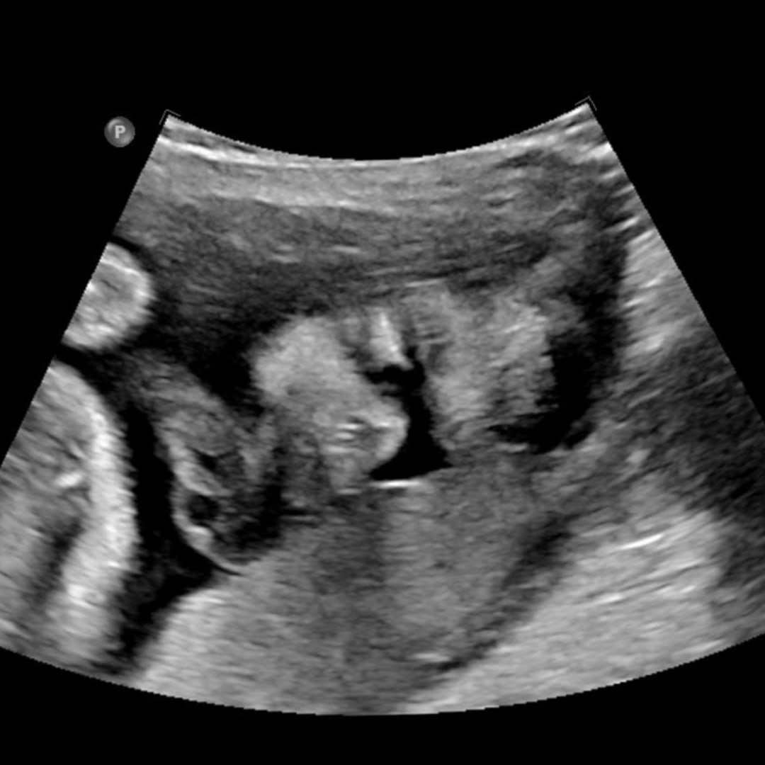 Photo shared by Fay for their Babylist baby registry.