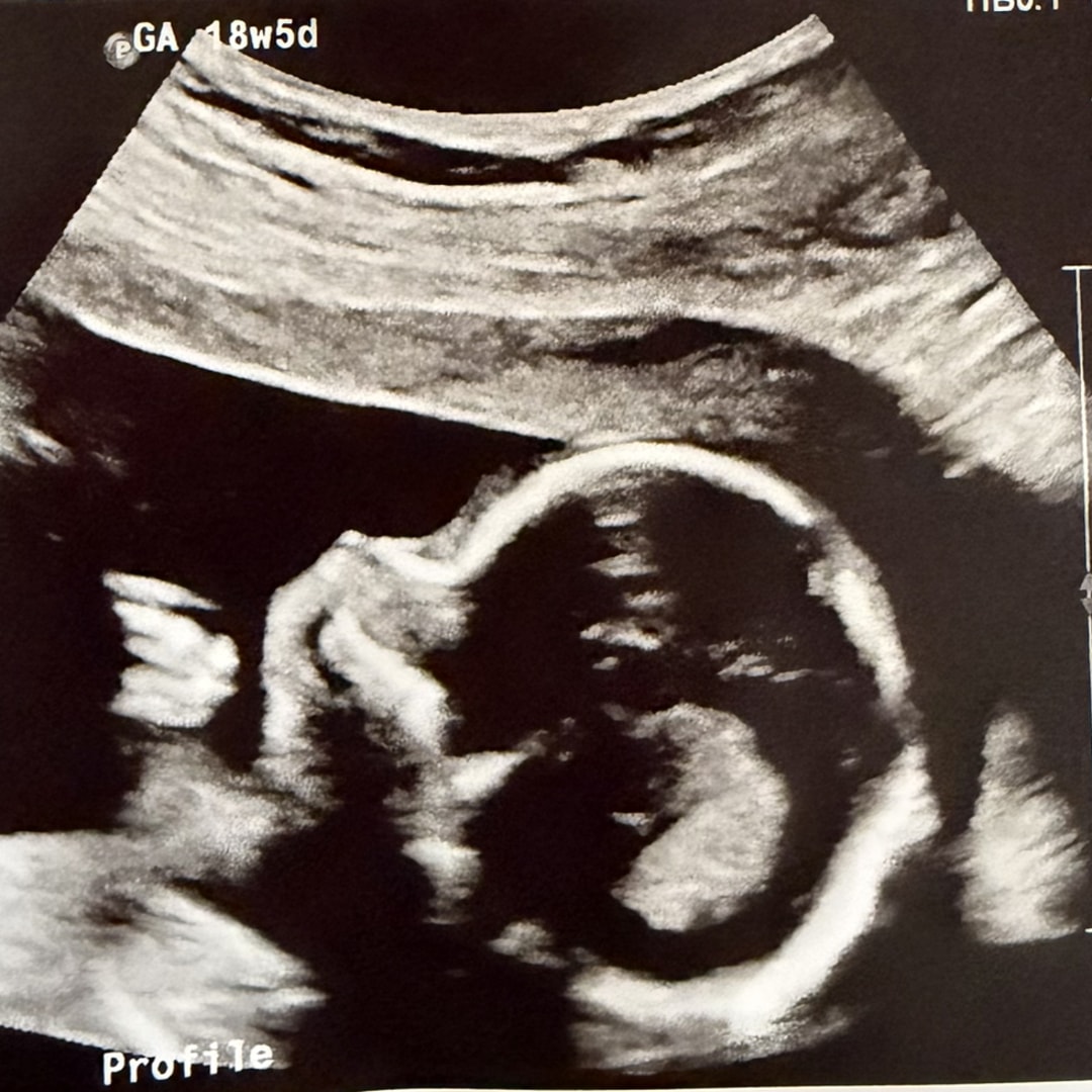 Photo shared by Ellen for their Babylist baby registry.