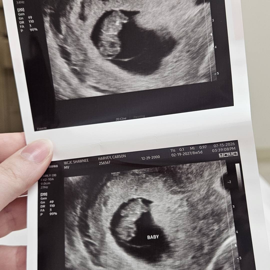 Photo shared by Carson for their Babylist baby registry.