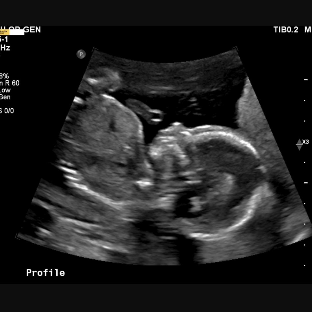 Photo shared by Erica for their Babylist baby registry.