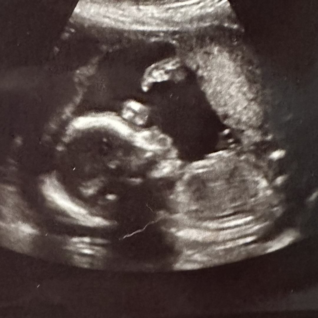 Photo shared by Emily for their Babylist baby registry.