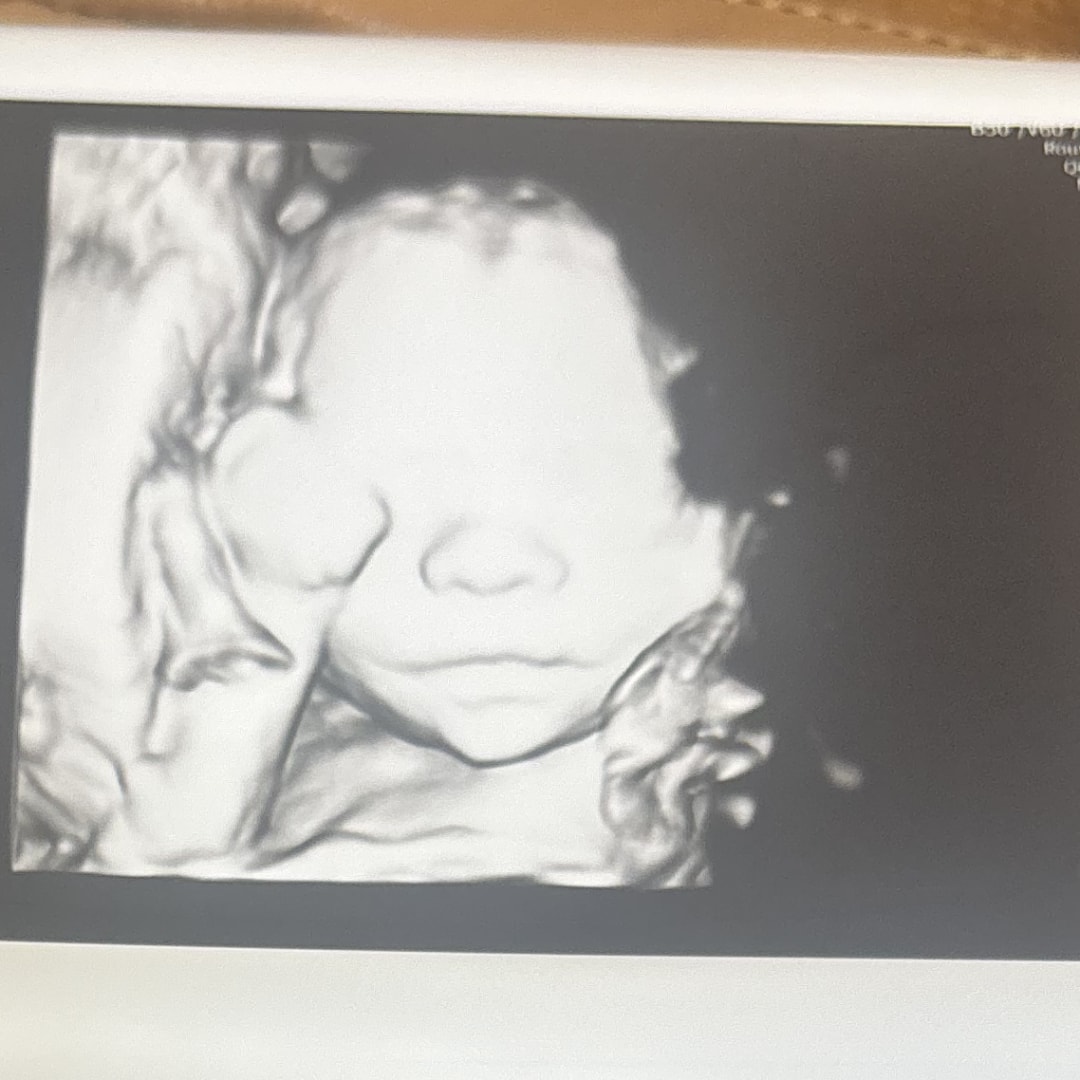 Photo shared by Sierra for their Babylist baby registry.