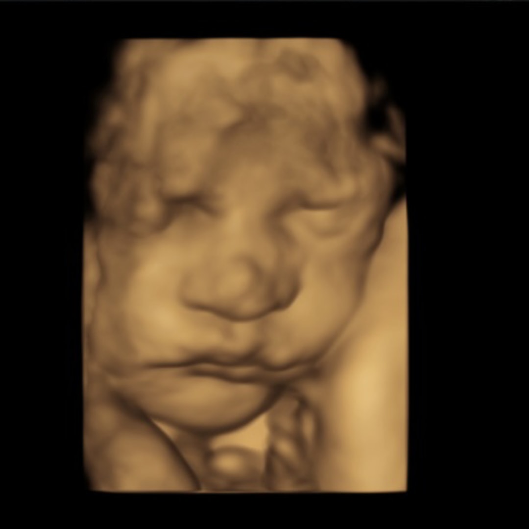 Photo shared by Alyssa for their Babylist baby registry.