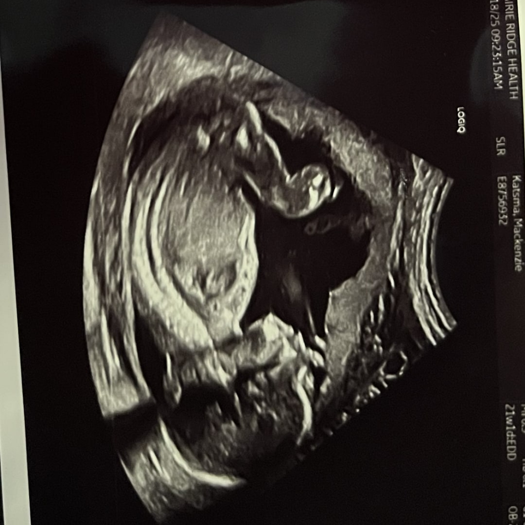 Photo shared by Kenzie for their Babylist baby registry.