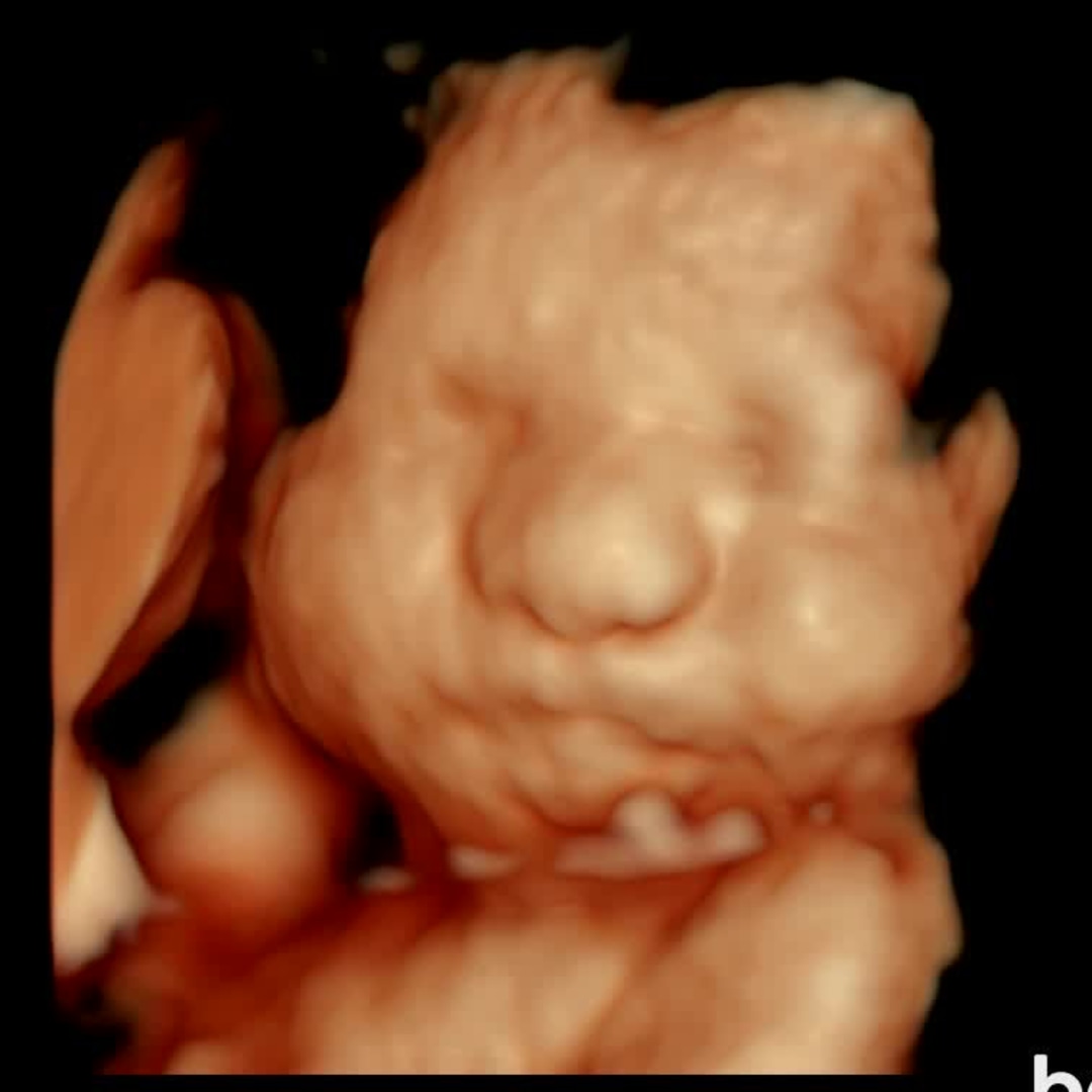 Photo shared by Arjin for their Babylist baby registry.