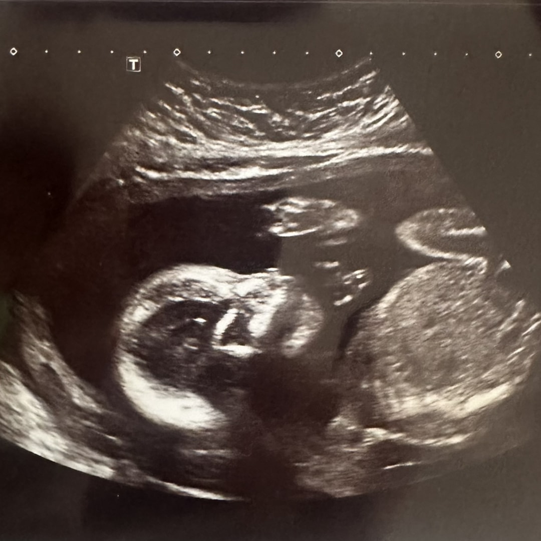 Photo shared by Bobby for their Babylist baby registry.