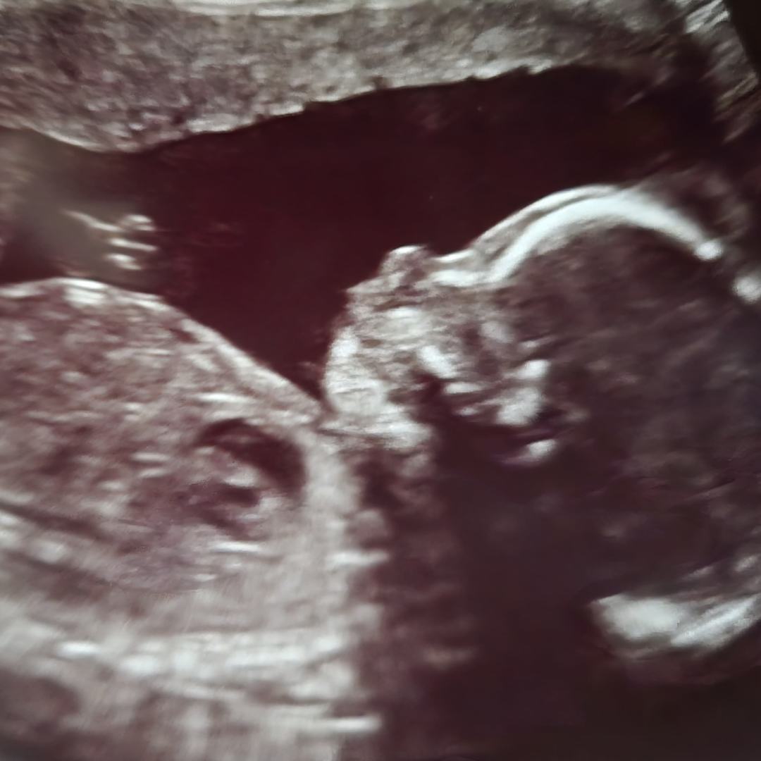 Photo shared by Heather for their Babylist baby registry.