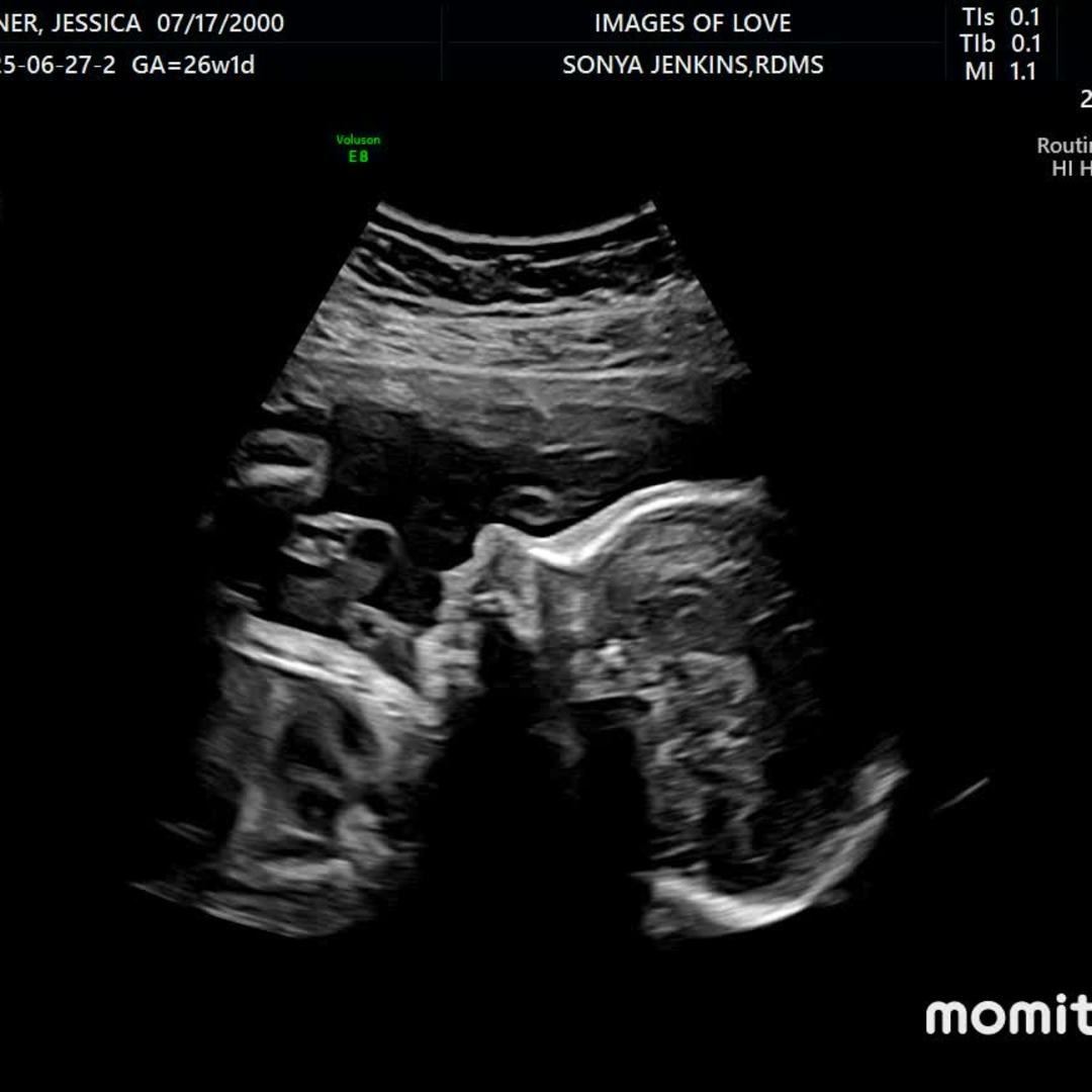 Photo shared by Jessica for their Babylist baby registry.
