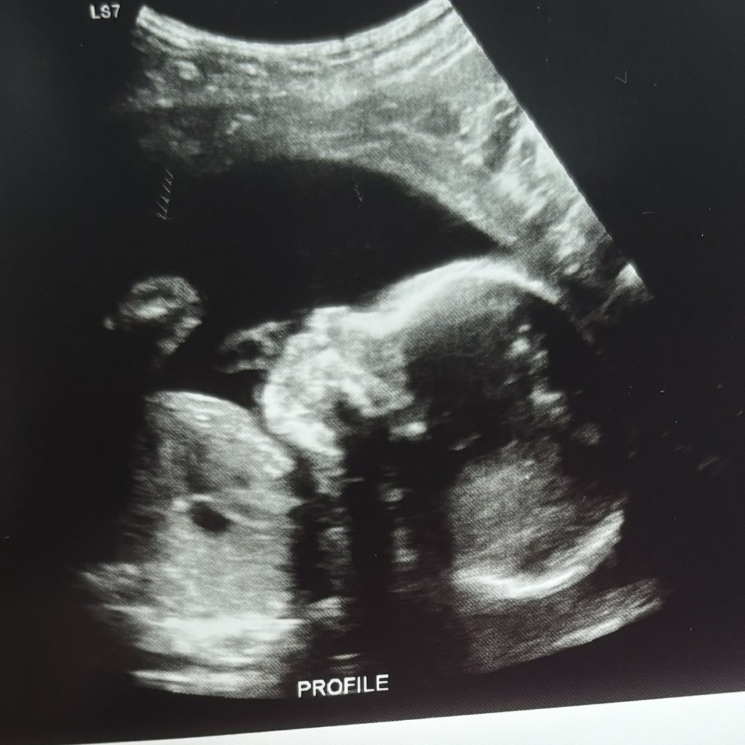 Photo shared by Jada for their Babylist baby registry.