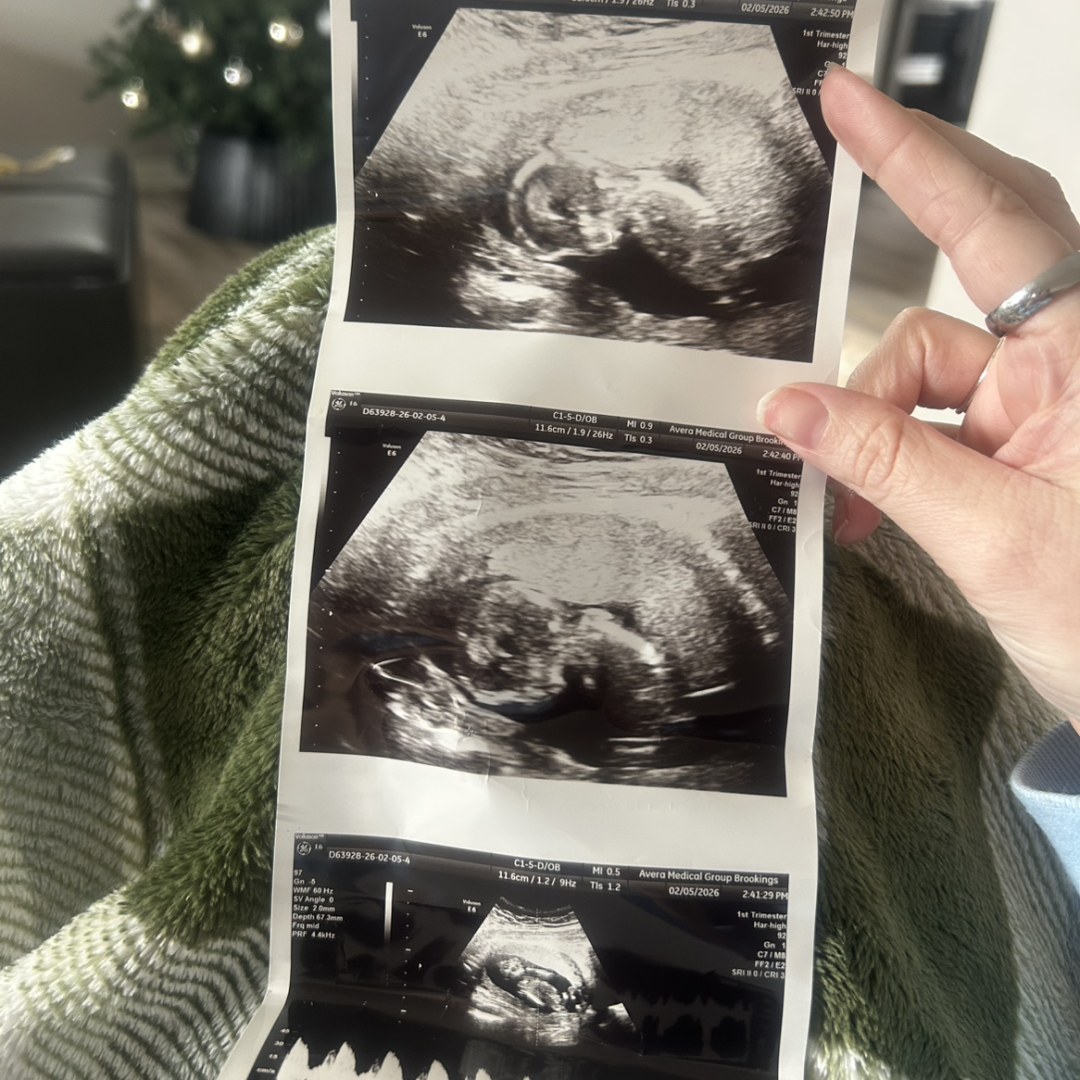 Photo shared by Callie for their Babylist baby registry.