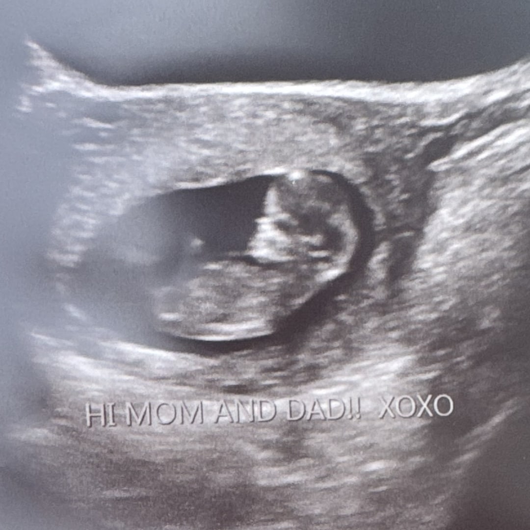 Photo shared by Brianna for their Babylist baby registry.