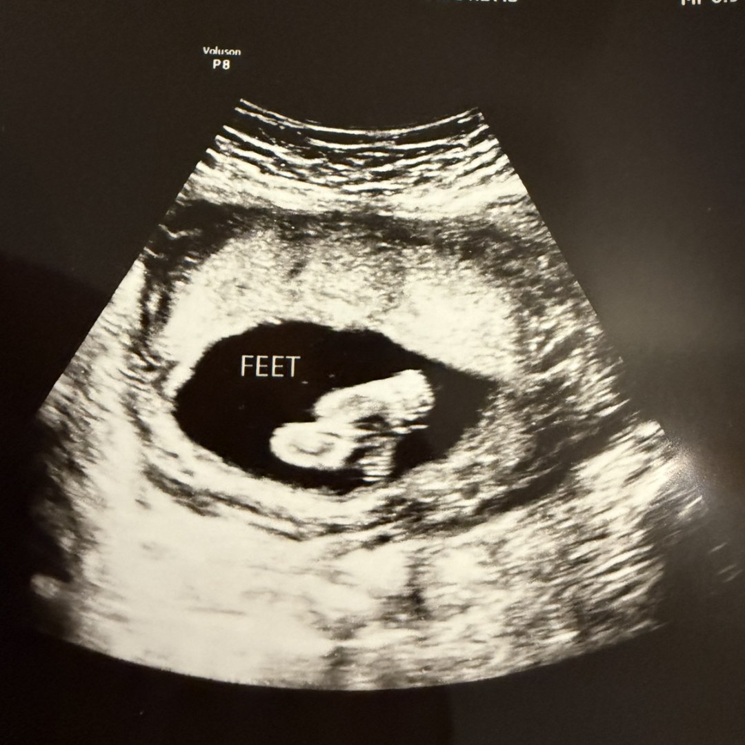 Photo shared by Annie for their Babylist baby registry.