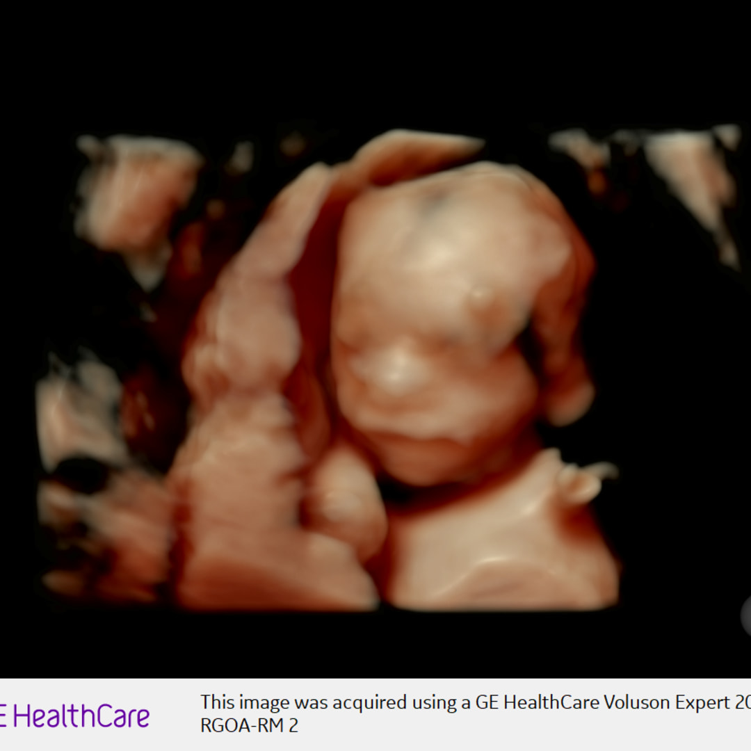 Photo shared by Alexa for their Babylist baby registry.