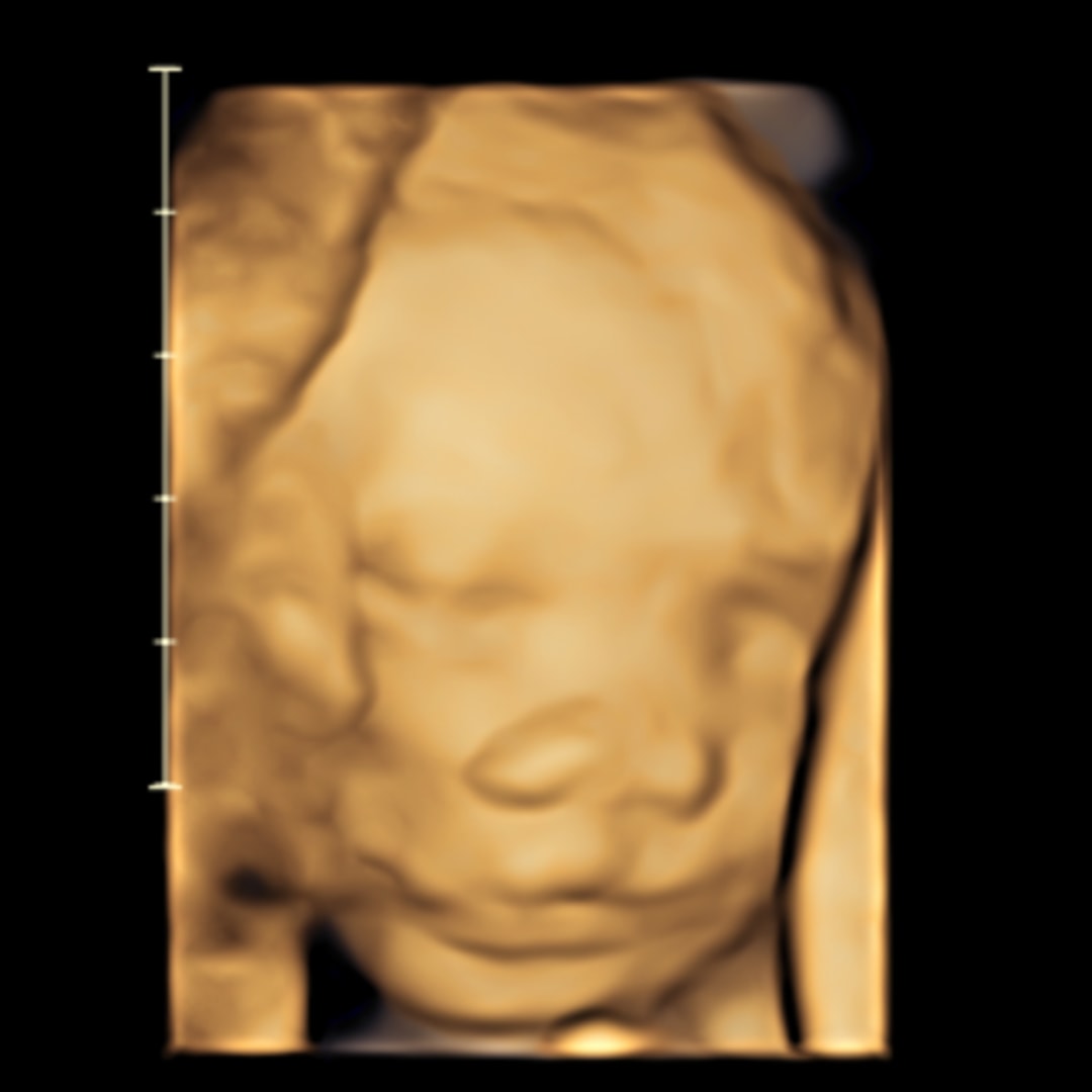 Photo shared by Francheska for their Babylist baby registry.