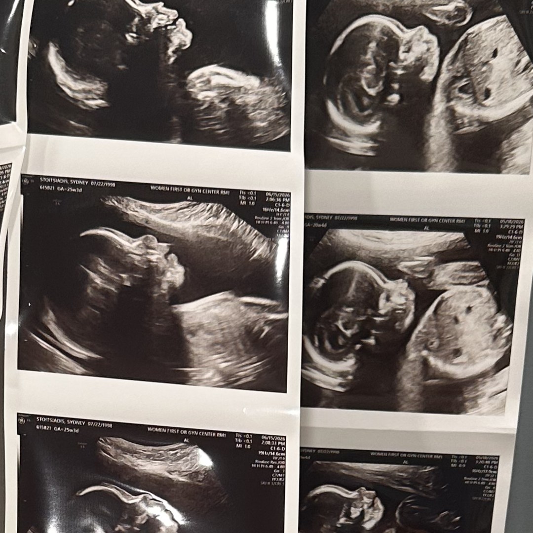 Photo shared by Sydney for their Babylist baby registry.